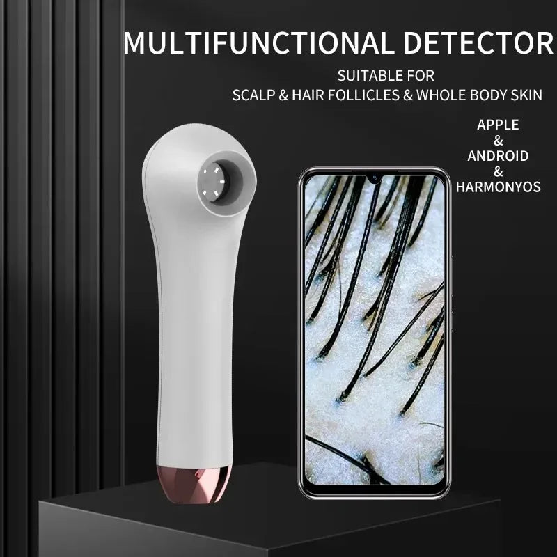 Vilnason Scalp & Skin Analyzer – HD Borescope Camera Tool Skin Analyzer Camera Qst