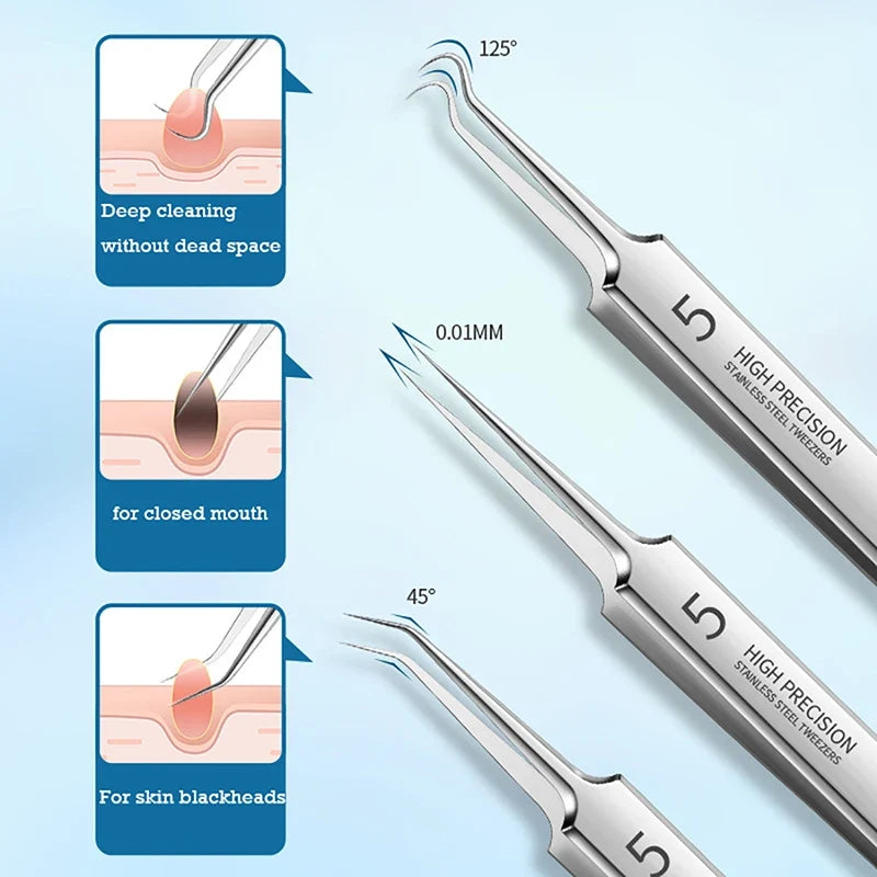 Precision Stainless Steel Blackhead & Pore Cleansing Tweezers Facial Skincare Tool Qme