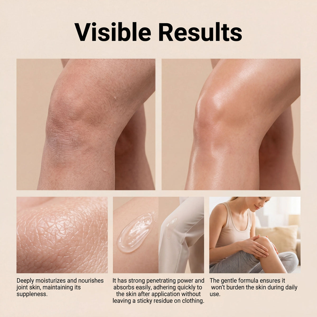 Ximonth Bee Venom Joint Care Cream | Daily Moisturizer Body Moisturizing Cream Qst