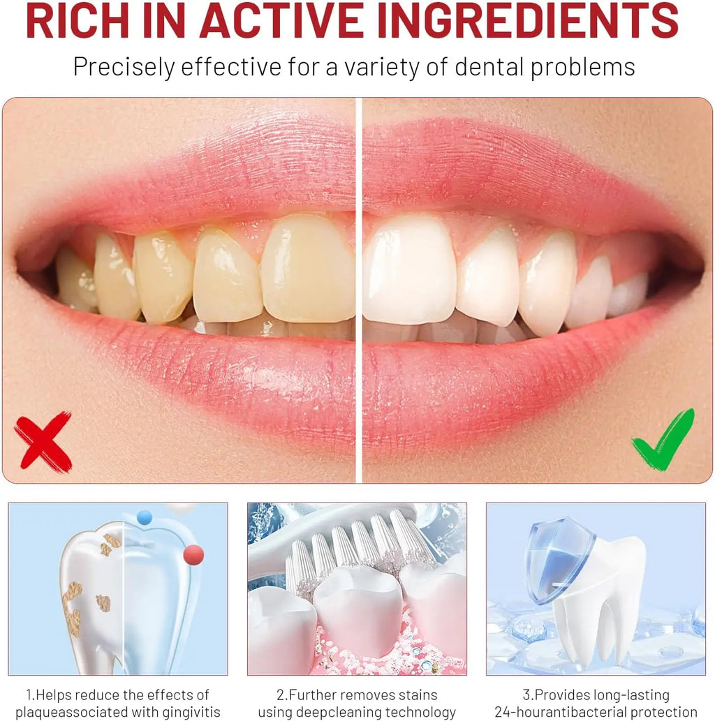Niacinamide Whitening Toothpaste – Brightens & Protects Enamel Whitening Toothpaste Qme