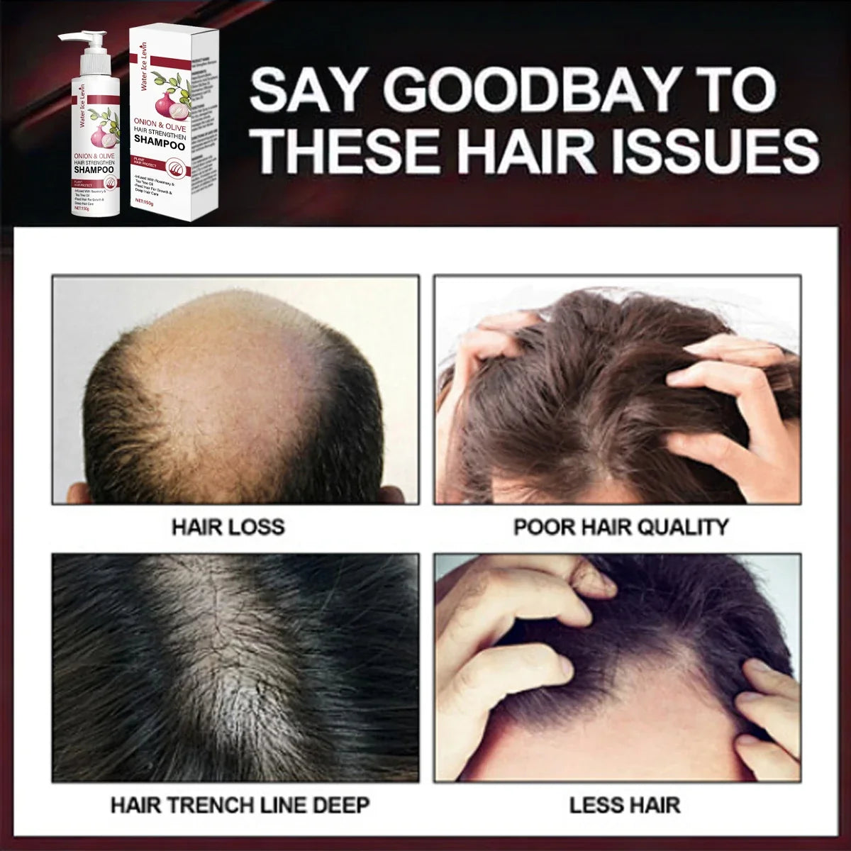 Onion & Olive Hair Strengthening Shampoo – Biotin & Rosemary Hair Strengthening Shampoo Qme