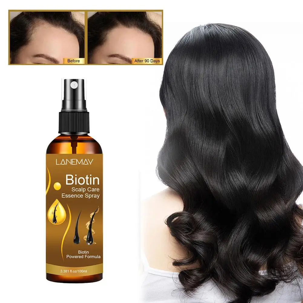 Biotin Scalp Care Essence Spray Serum | Nourishing Hair Treatment Scalp Serum Spray Qme