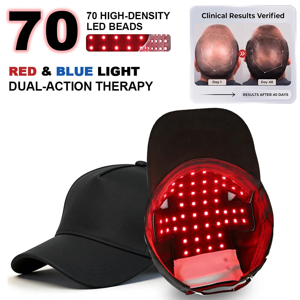 70 LED Red & Blue Light Hair Growth Cap | Scalp Massager Hair Growth Therapy Cap Qst