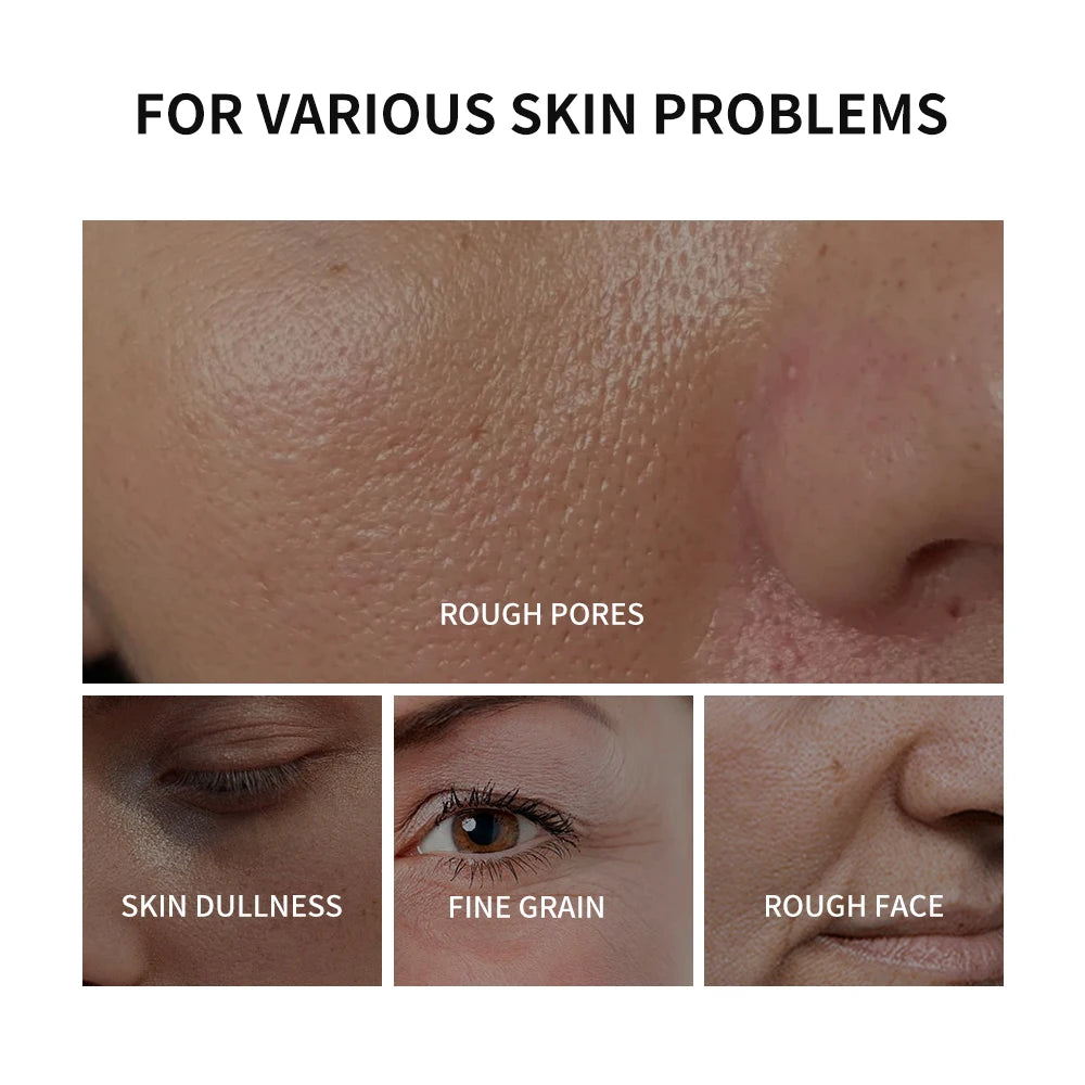 Lakerain Face Blurring Primer – Moisturizing Skin Tightener 30ml Makeup Primer Qst