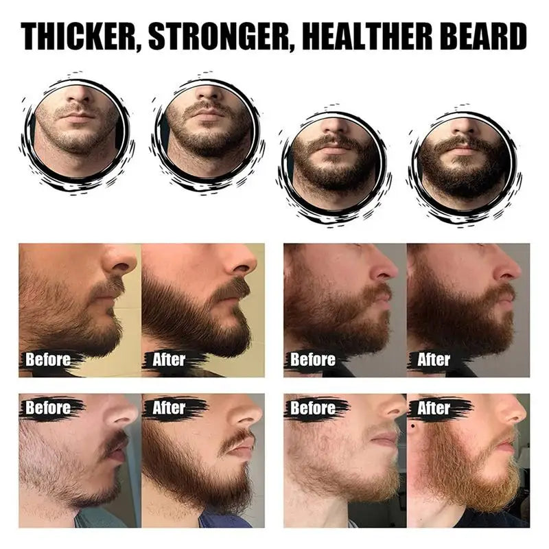 Men's Beard Growth Essential Oil Kit – Nourish & Enhance Beard Care Kit Qme