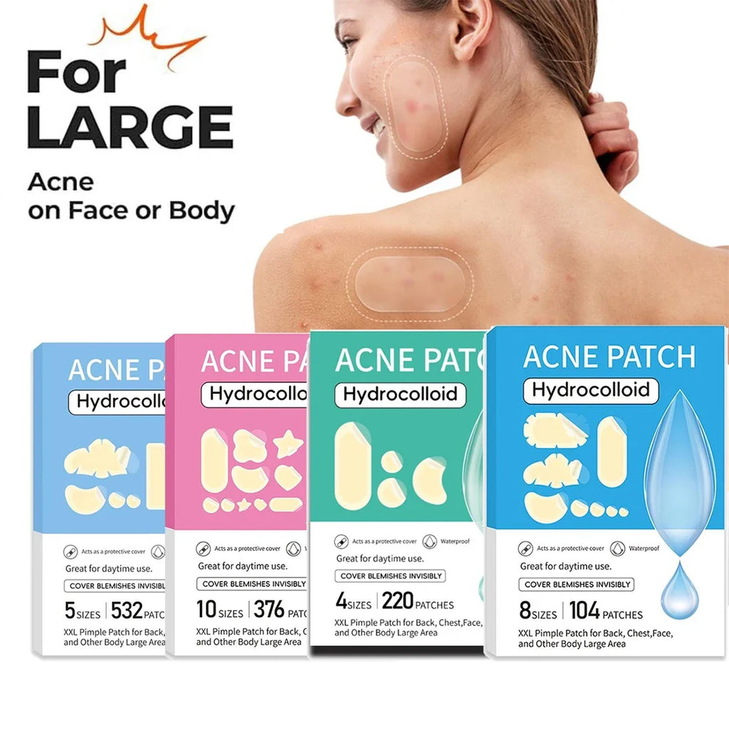 Hydrocolloid Pimple Patches Bulk – 5 Sizes for Face & Body Acne Pimple Patches Qme