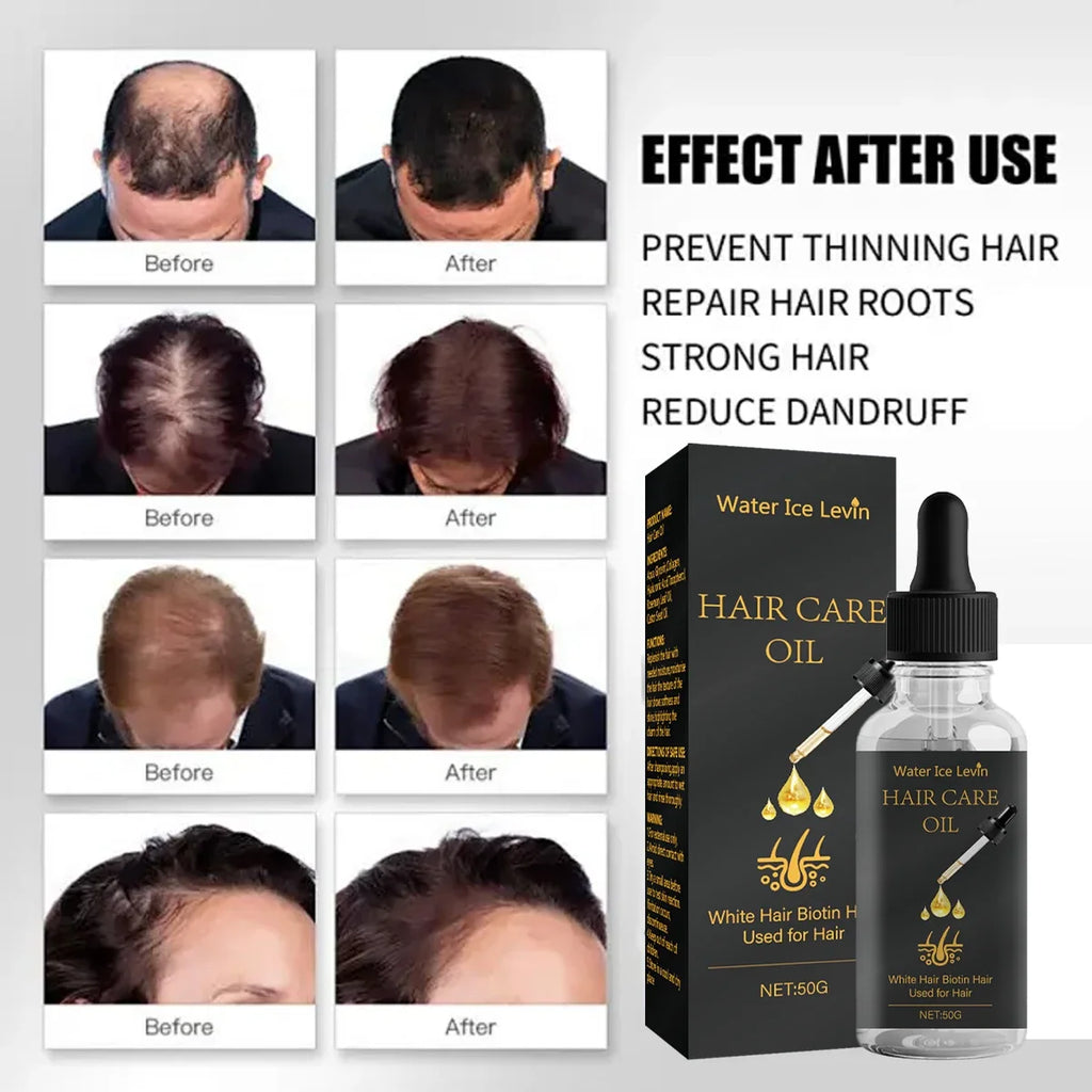 Biotin Hair Care Oil – Rosemary, Castor & Collagen Blend Hair Care Oil Qme