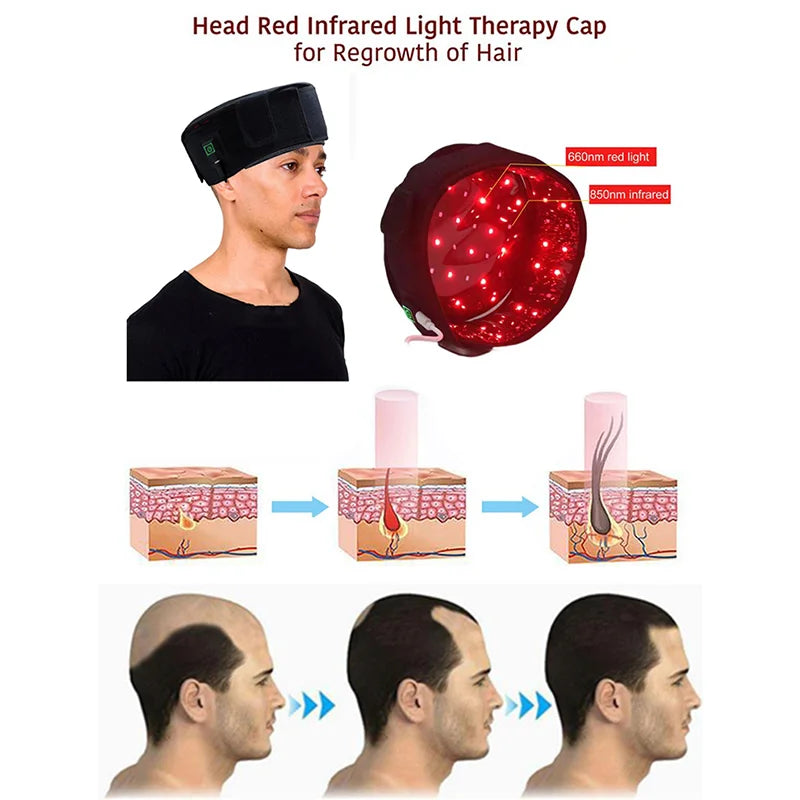 70-LED Red Light Therapy Hair Cap – 660nm & 850nm Growth LED Hair Growth Cap Qst