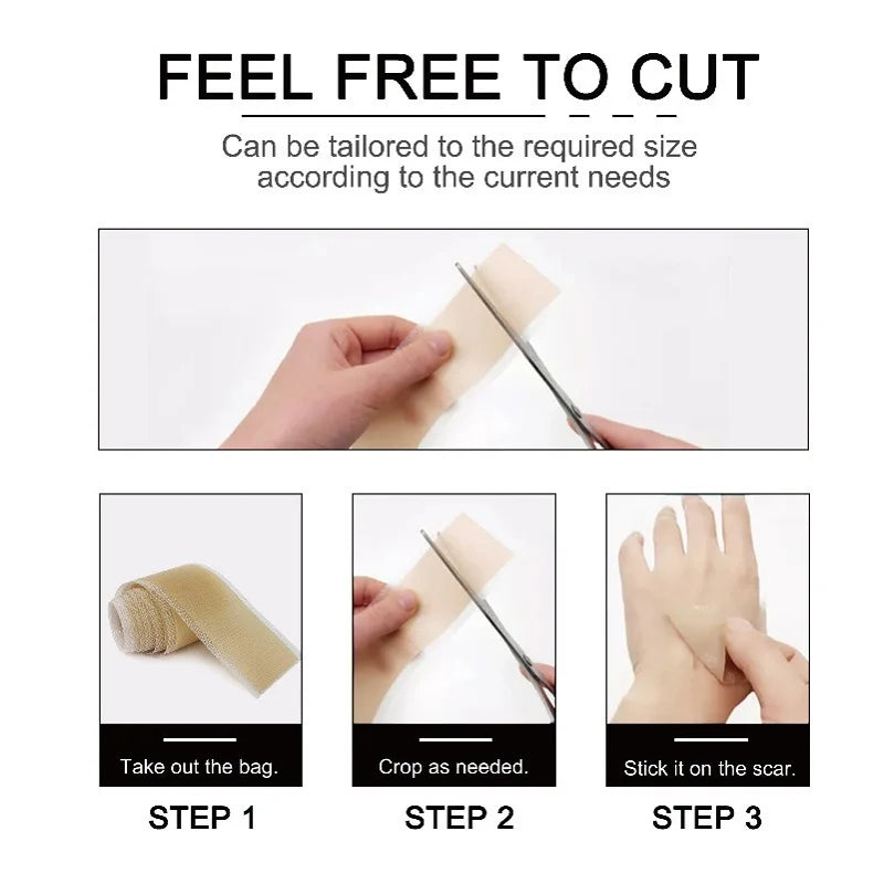 Silicone Scar Sheets Roll 4cm×150cm – Reusable Self-Adhesive Silicone Scar Sheet Qme