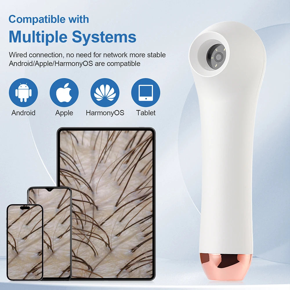 Scalp & Hair Follicle Analyzer – 4X HD Pore Skin Detector Scalp Skin Analyzer Qst