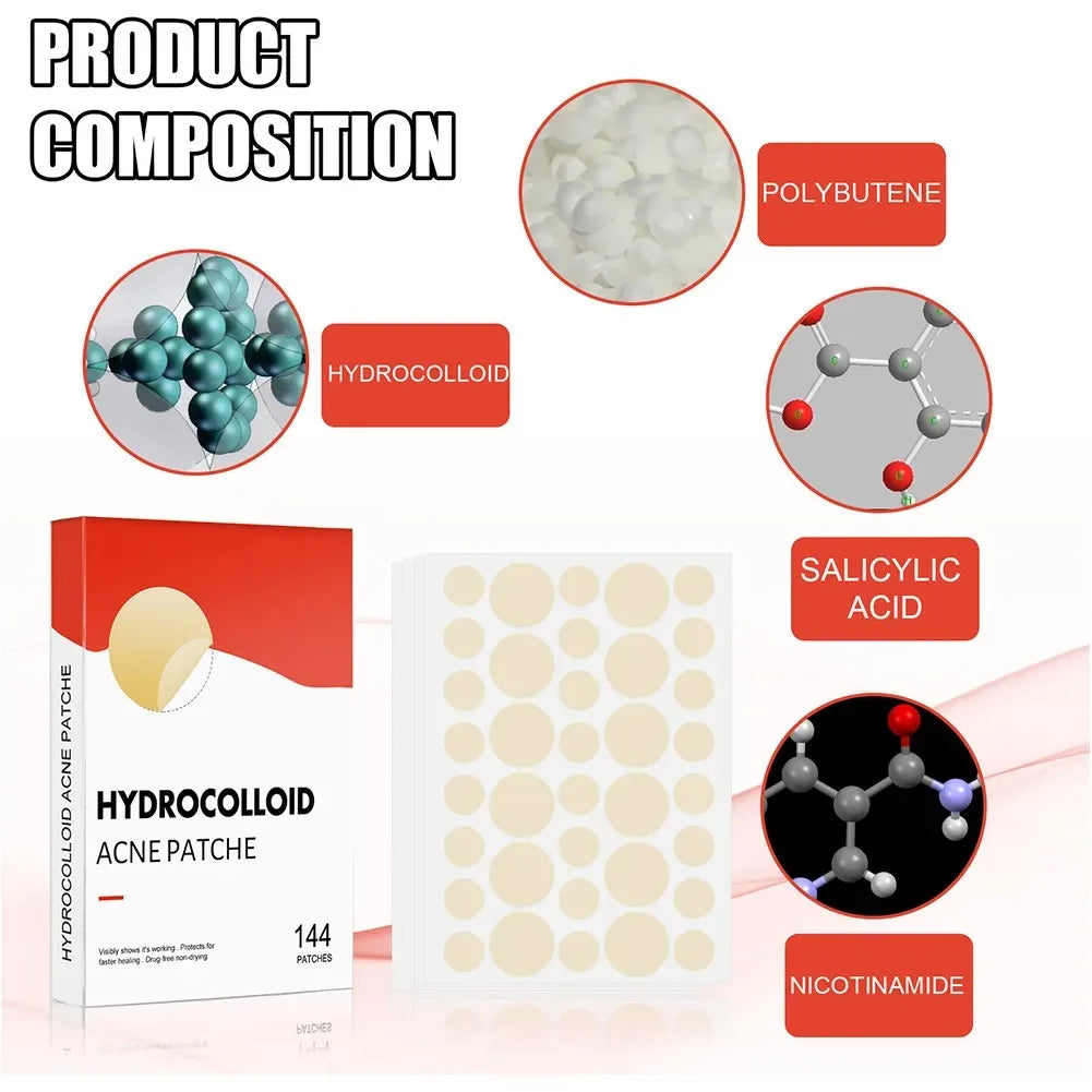 Eelhoe 144pc Hydrocolloid Acne Patches – Clear Spot Stickers Acne Patch Set Qst