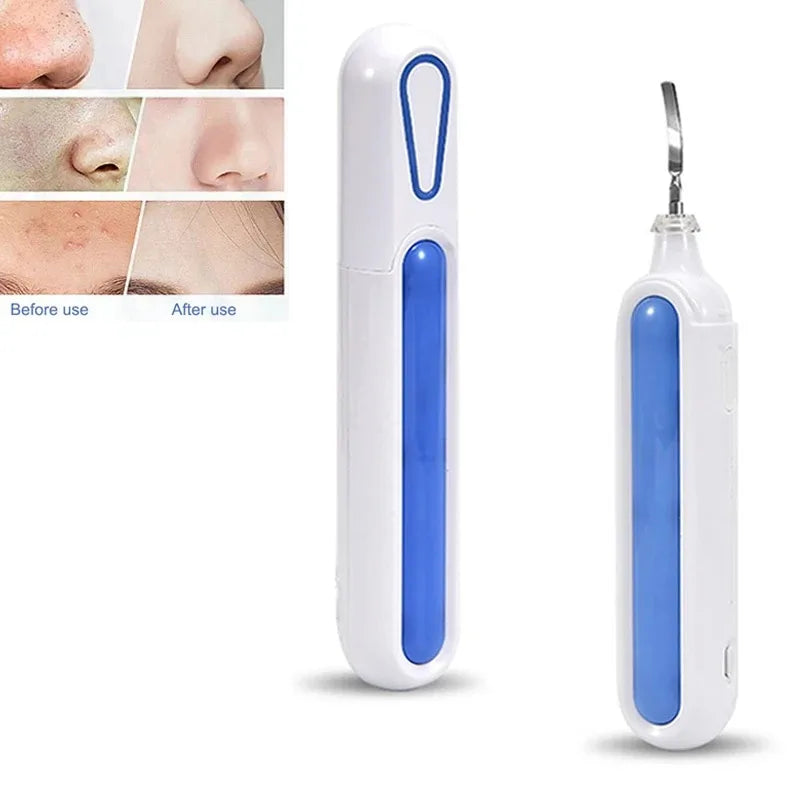 Ultrasonic Skin Scrubber Spatula – Portable Pore Cleansing Tool Facial Cleansing Device Qst