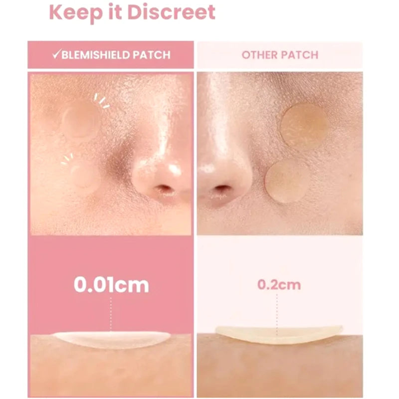 360pcs Invisible Acne Pimple Patches – Heart & Star Shapes Acne Pimple Patch Qst