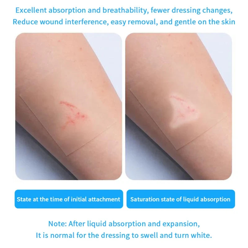 Hydrocolloid Self-Adhesive Patches – Breathable Invisible Skin Hydrocolloid Skin Patch Qme