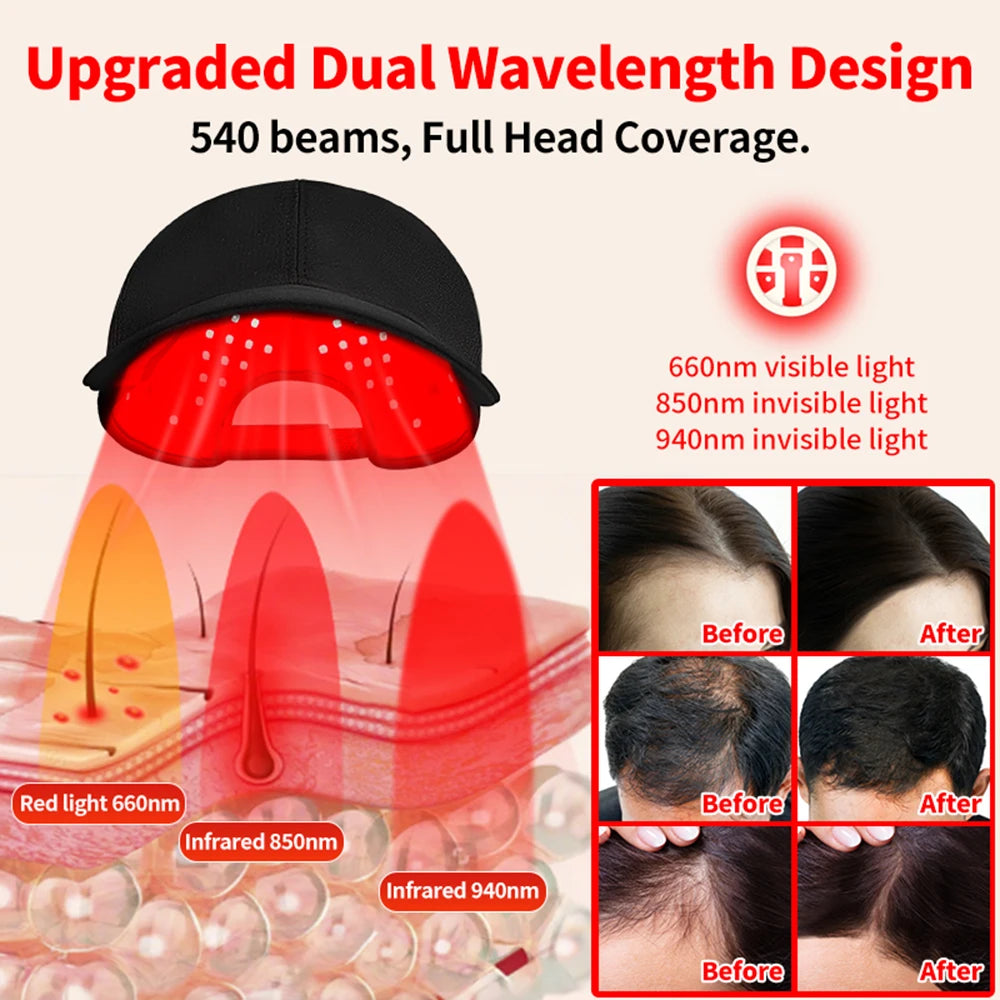 Vilnason LED Hair Growth Cap – Red Light 660nm 850nm 940nm LED Hair Growth Cap Qst