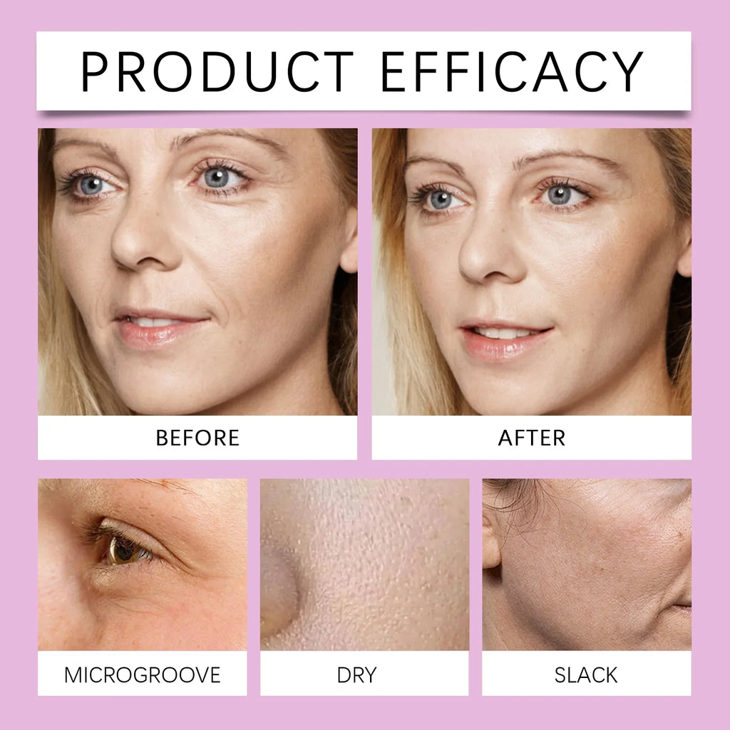 EELHOE Collagen Lifting Serum – Fade Fine Lines & Hydrate Collagen Facial Serum Qme