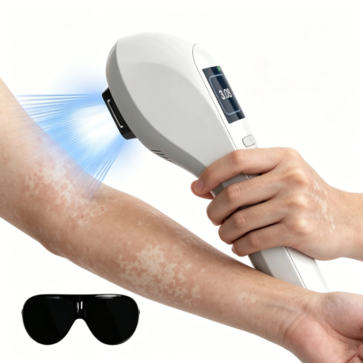 308nm UVB LED Phototherapy Lamp Home Use – LCD Timer UVB Phototherapy Lamp Qst
