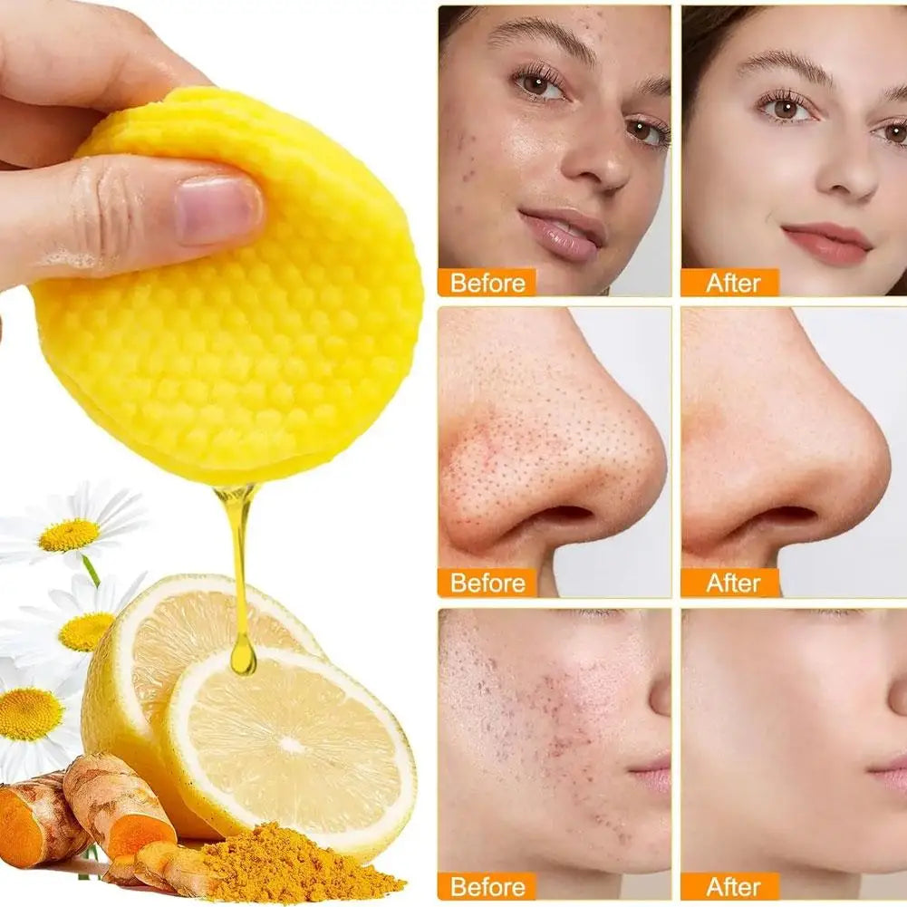 Turmeric & Kojic Acid Exfoliating Cleansing Pads – 50 Pcs Exfoliating Cleansing Pads Qme