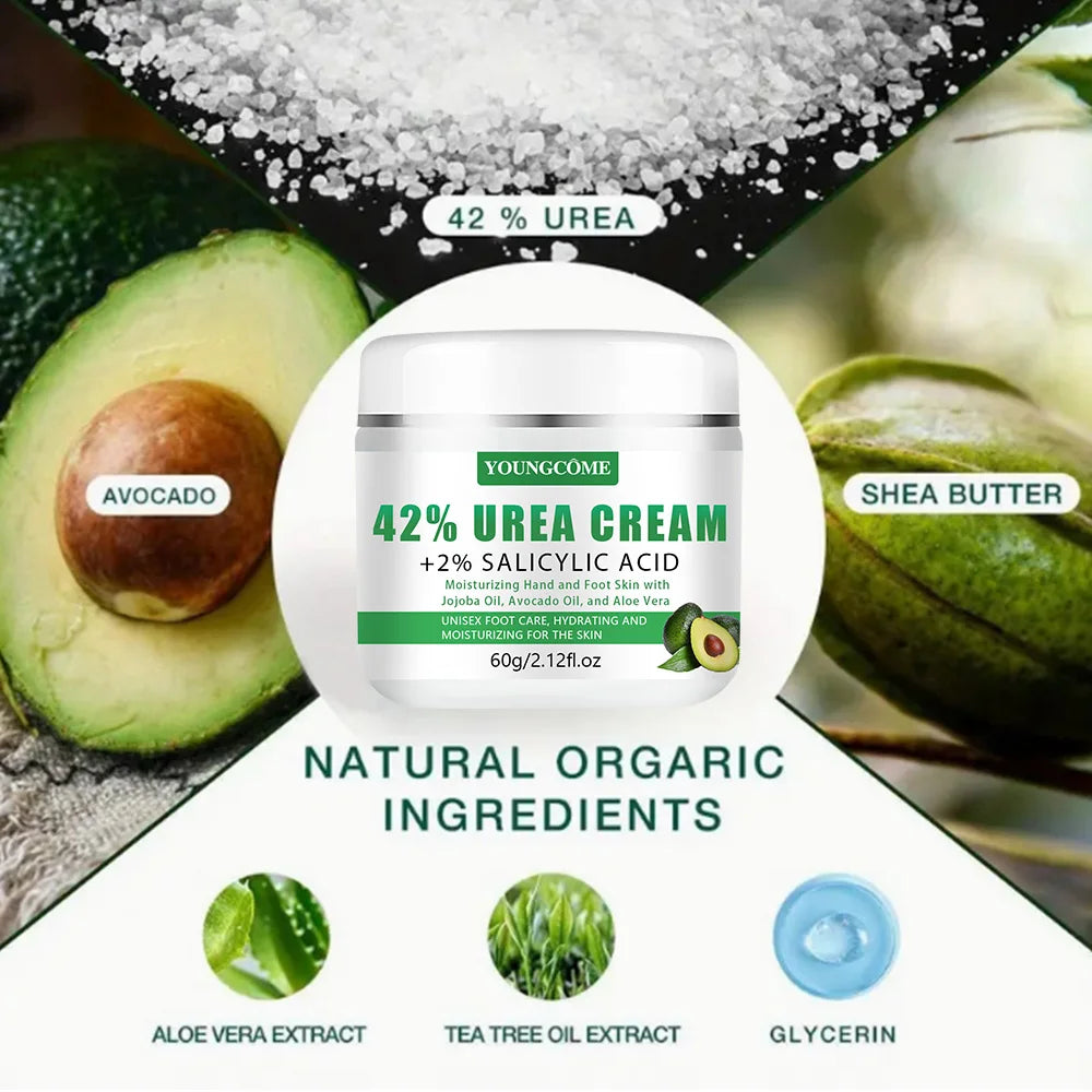 YOUNGCOME 42% Urea Avocado Foot Cream – Dry Skin & Calluses Foot Cream Qst