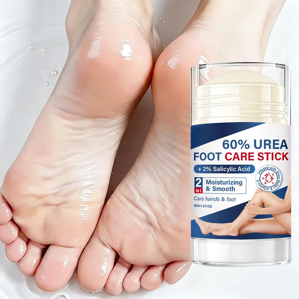 60% Urea Foot Care Stick – Shea Butter & Vitamin E Balm Foot Care Balm Stick Qst